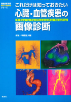 画像診断別冊ＫＥＹＢＯＯＫシリーズ『これだけは知っておきたい心臓・血管疾患の画像診断』