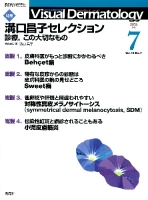 Ｖｉｓｕａｌ　Ｄｅｒｍａｔｏｌｏｇｙ『Ｖｉｓｕａｌ　Ｄｅｒｍａｔｏｌｏｇｙ　２０１３年７月号　Ｖｏｌ．１２　Ｎｏ．７』