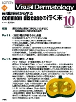 Ｖｉｓｕａｌ　Ｄｅｒｍａｔｏｌｏｇｙ『Ｖｉｓｕａｌ　Ｄｅｒｍａｔｏｌｏｇｙ　２０１３年１０月号Ｖｏｌ．１２Ｎｏ．１０』