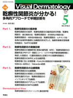 Ｖｉｓｕａｌ　Ｄｅｒｍａｔｏｌｏｇｙ『Ｖｉｓｕａｌ　Ｄｅｒｍａｔｏｌｏｇｙ　２０１６年５月号　Ｖｏｌ．１５　Ｎｏ．５』