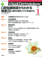 Ｖｉｓｕａｌ　Ｄｅｒｍａｔｏｌｏｇｙ『Ｖｉｓｕａｌ　Ｄｅｒｍａｔｏｌｏｇｙ　２０１７年１月号　Ｖｏｌ．１６　Ｎｏ．１』