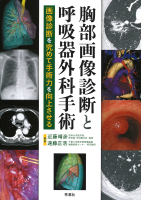 『胸部画像診断と呼吸器外科手術　画像診断を究めて手術力を向上させる』
