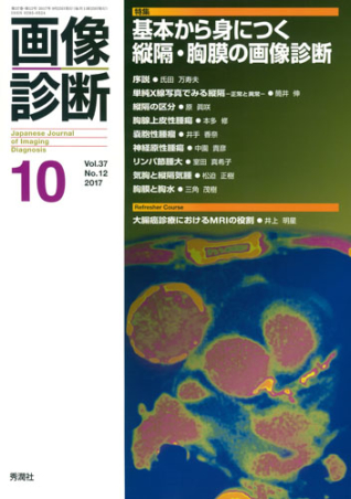 画像診断『画像診断２０２４年７月号 Ｖｏｌ．４４ Ｎｏ．８ 臨床所見から考える婦人科画像診断』 ｜ 学研出版サイト -  www.unidentalce.com.br