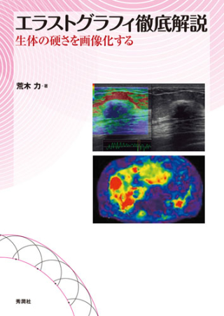 エラストグラフィ徹底解説 生体の硬さを画像化する』 ｜ 学研出版サイト