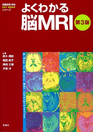青木茂樹 よくわかる脳MRI 改訂第4版 画像診断別冊KEY BOOKシリーズ ...