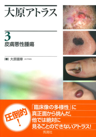 大原アトラス 3 皮膚悪性腫瘍-bbmancha.org