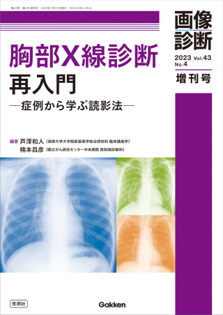 画像診断増刊号『画像診断２０２３年増刊号Ｖｏｌ．４３ Ｎｏ．４ 胸部 ...