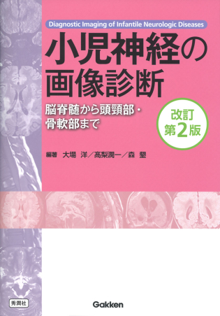 神経内科疾患の画像診断 第2版 神経内科疾患の画像診断 第2版 | 柳下 章 |本 | 通販 | Amazon