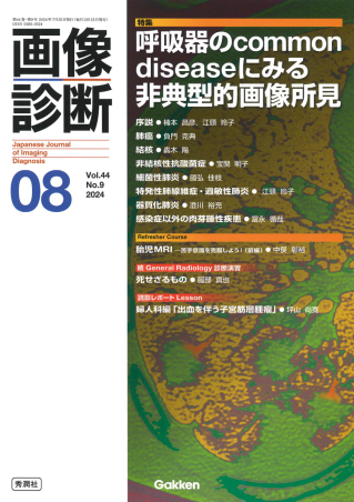 画像診断 08年7月号 (28-8) 画像診断 08年6月号 (28-7) |本 | 通販 | Amazon