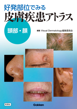 好発部位でみる皮膚疾患アトラス 頭部・顔』 ｜ 学研出版サイト