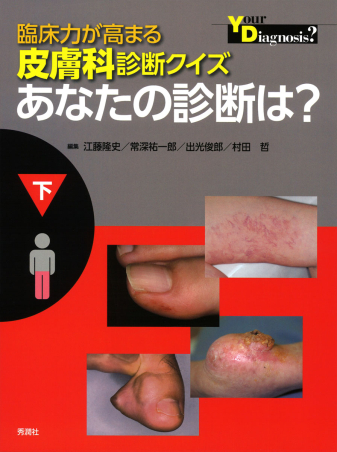 臨床力が高まる皮膚科診断クイズあなたの診断は? 上 臨床力が高まる皮膚科診断クイズ 下 あなたの診断は？』 ｜ 学研出版サイト