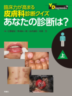 『臨床力が高まる皮膚科診断クイズ　上　あなたの診断は？』