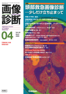 画像診断『画像診断２０２３年４月号　Ｖｏｌ．４３　Ｎｏ．５　頭部救急画像診断―少しだけ立ち止まって』