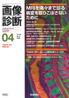 画像診断『画像診断２０２５年４月号　Ｖｏｌ．４５　Ｎｏ．５』