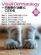 Ｖｉｓｕａｌ　Ｄｅｒｍａｔｏｌｏｇｙ『Ｖｉｓｕａｌ　Ｄ．　２０２５年１０月号　Ｖｏｌ．２４　Ｎｏ．１０　爪疾患の「治療」にこだわる』