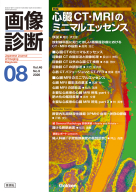 画像診断『画像診断２０２６年８月号　Ｖｏｌ．４６　Ｎｏ．９　心臓ＣＴ・ＭＲＩのミニマルエッセンス』